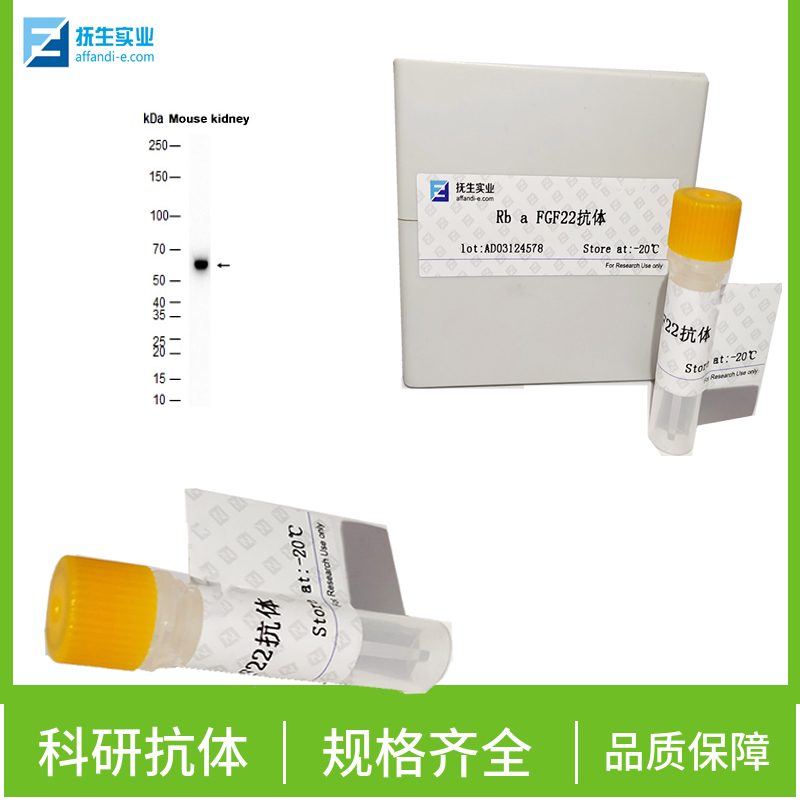 G蛋白偶联受体71抗体,TAS1R2 Rabbit pAb