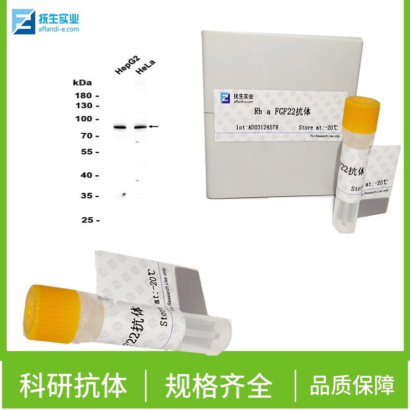 G蛋白偶联受体GPR92蛋白抗体,GPR92 Rabbit pAb