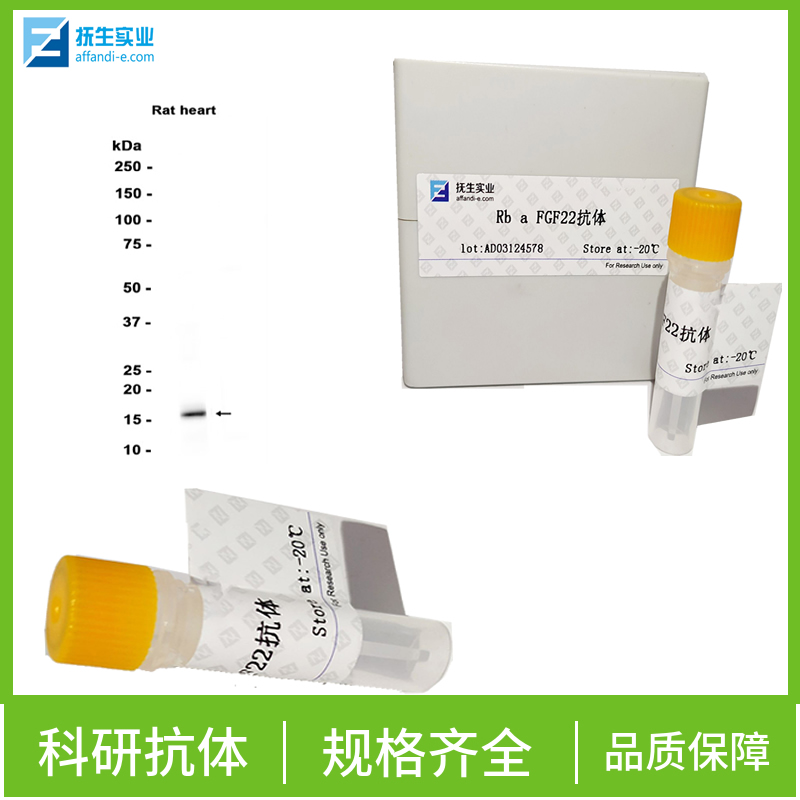 HEG同源蛋白1抗体,HEG1 Rabbit pAb