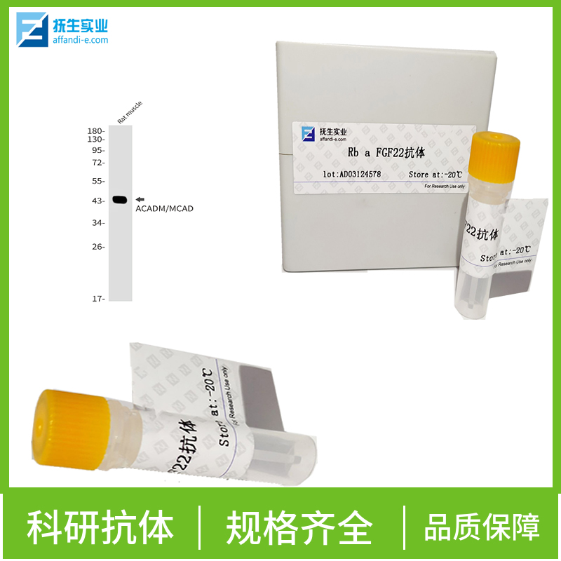 HER2单克隆抗体,C-erbB-2/HER2 Mouse mAb