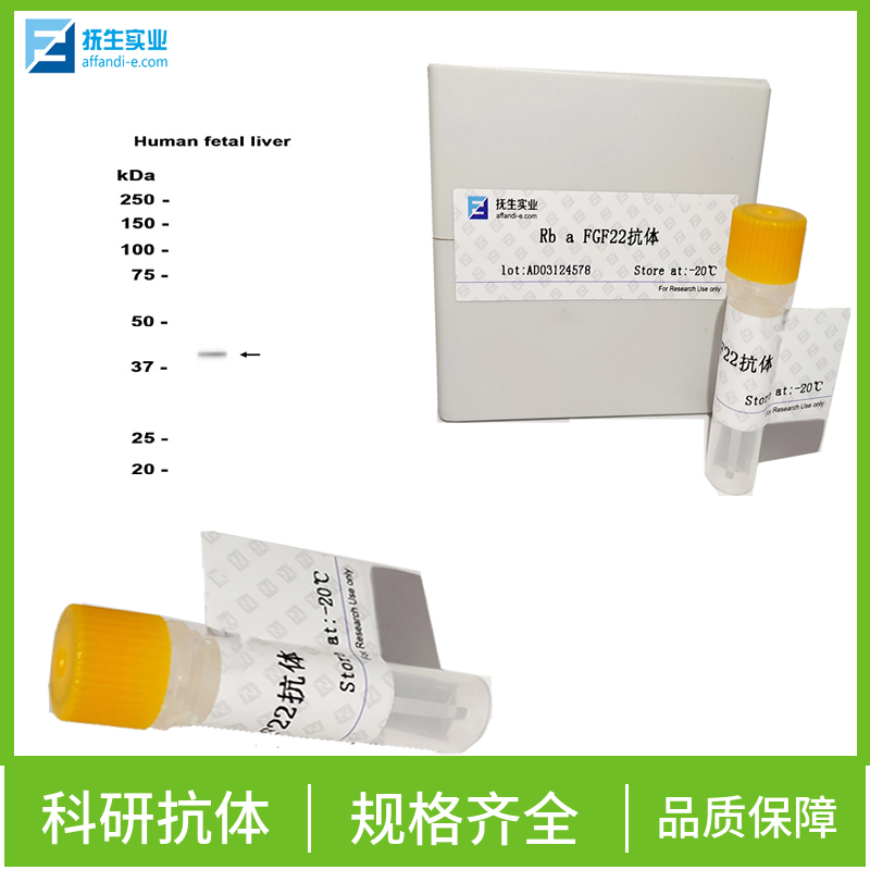 HERC6 E3泛素蛋白连接酶抗体,HERC6 Rabbit pAb