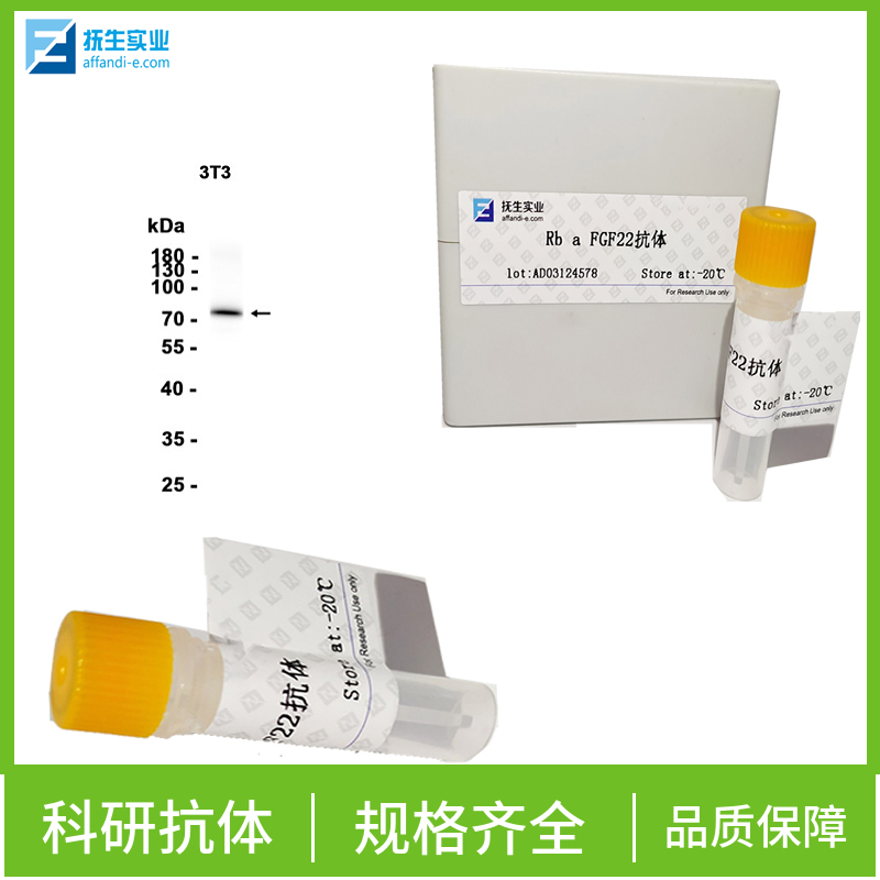 IgLON家族蛋白5抗体,IGLON5 Rabbit pAb