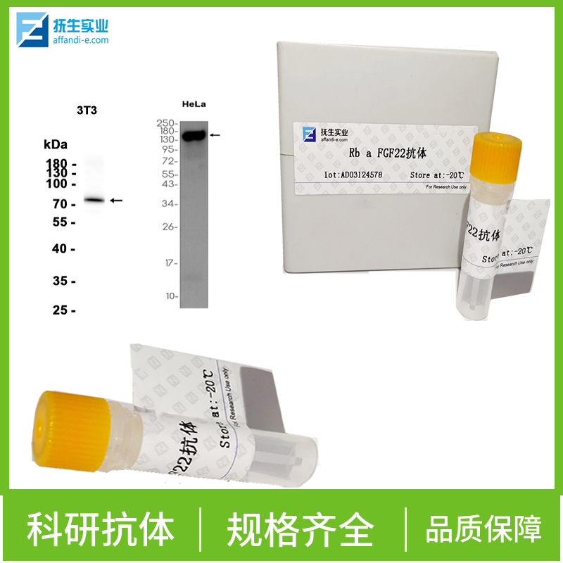 IRE1蛋白抗体,IRE1 Rabbit pAb