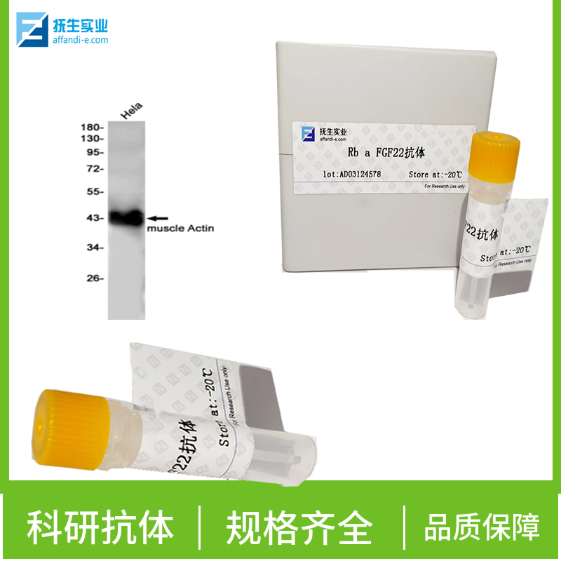 GLP-1单克隆抗体,GLP-1(1G9) Mouse mAb