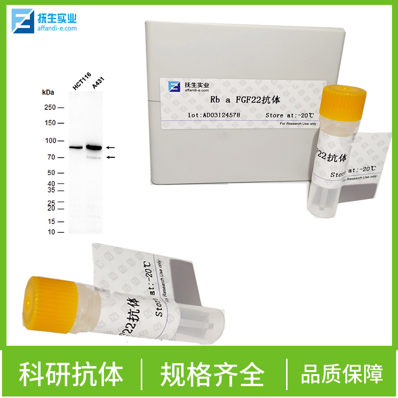 磷酸化Smad2抗体,phospho-Smad2 (Ser465) Rabbit pAb