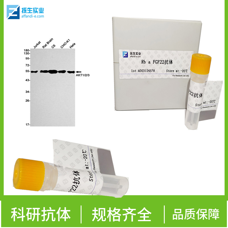 磷酸化叉头蛋白家族1(Ser319)抗体,Phospho-FoxO1 (Ser319) Rabbit pAb