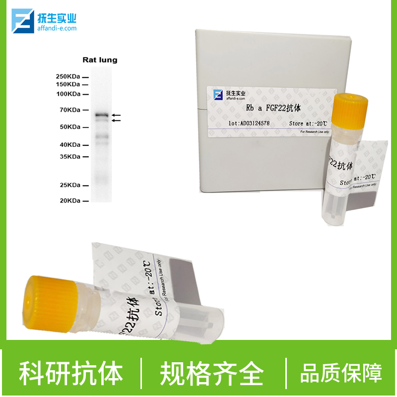 磷酸化蛋白激酶B抗体,phospho-AKT (Ser473) Rabbit pAb