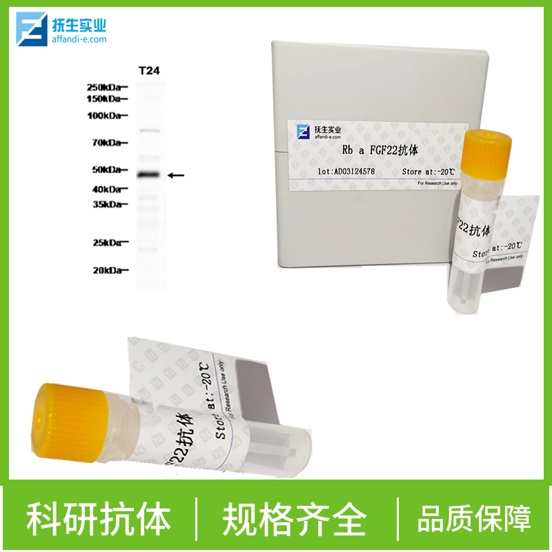 磷酸化蛋白酪氨酸激酶JAK-2抗体,phospho-JAK2 (Tyr1007+Tyr1008) Rabbit pAb