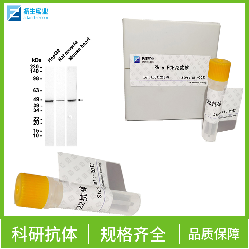 磷酸化蛋白质酪氨酸激酶JAK-1抗体,Phospho-Jak1 (Tyr1034 + Tyr1035) Rabbit pAb