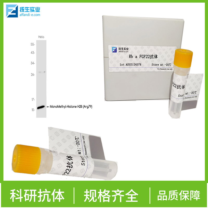 磷酸化核突触蛋白α抗体,phospho-Alpha synuclein (Ser129) Rabbit pAb