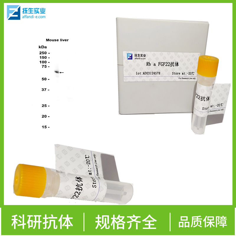 酪氨酸酶相关蛋白1抗体,TYRP1 Rabbit pAb