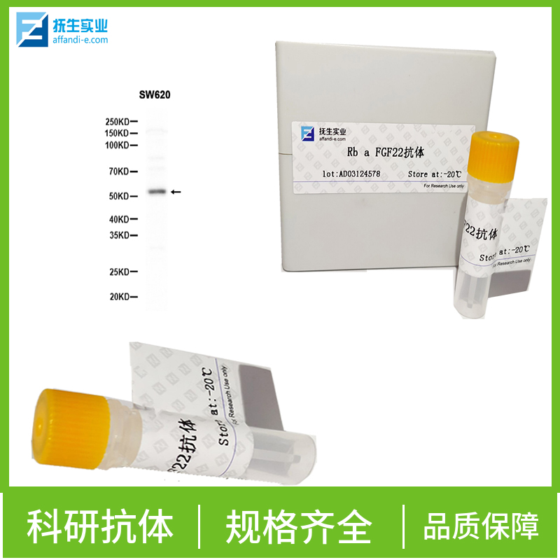 酪氨酸酶相关蛋白2抗体,TRP2 Rabbit pAb