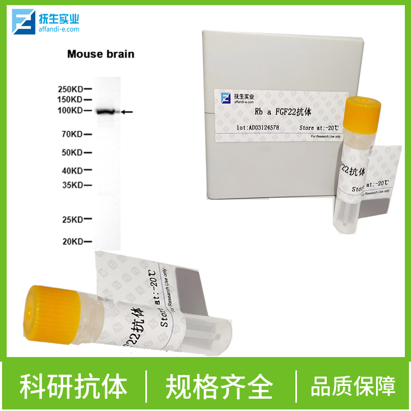 酪氨酸羟化酶抗体,Tyrosine Hydroxylase Rabbit pAb