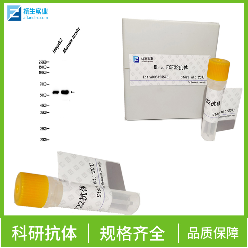 酪蛋白抗体,MGC149368.