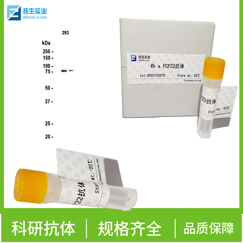 粒细胞-巨噬细胞集落刺激因子3抗体,G-CSF/CSF3 Rabbit pAb