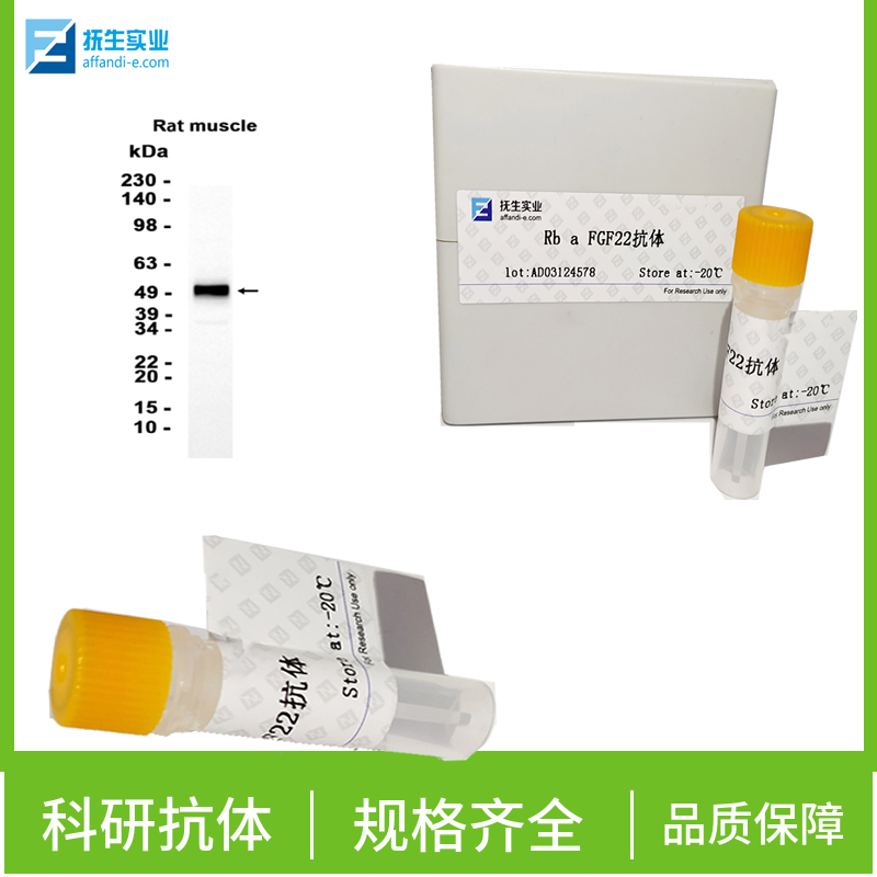 粒细胞-巨噬细胞集落刺激因子3受体抗体,GCSF Receptor Rabbit pAb