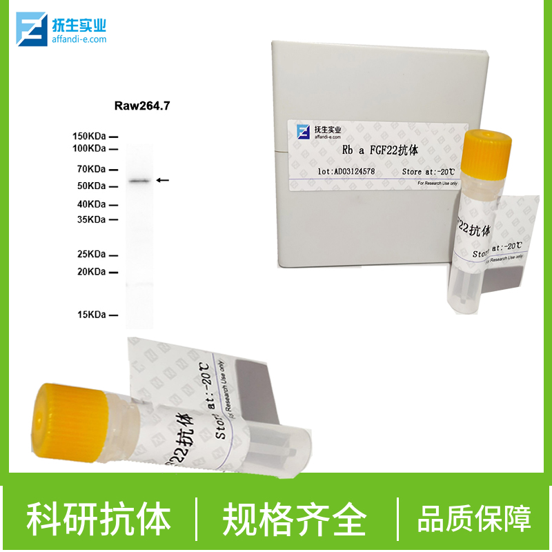 粒细胞-巨噬细胞克隆刺激因子抗体,GM-CSF Rabbit pAb