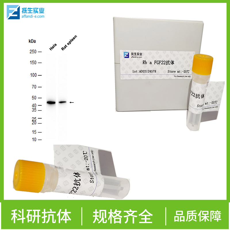 磷酸化cGMP依赖性蛋白激酶1抗体,phospho-cGKI (Thr515) Rabbit pAb