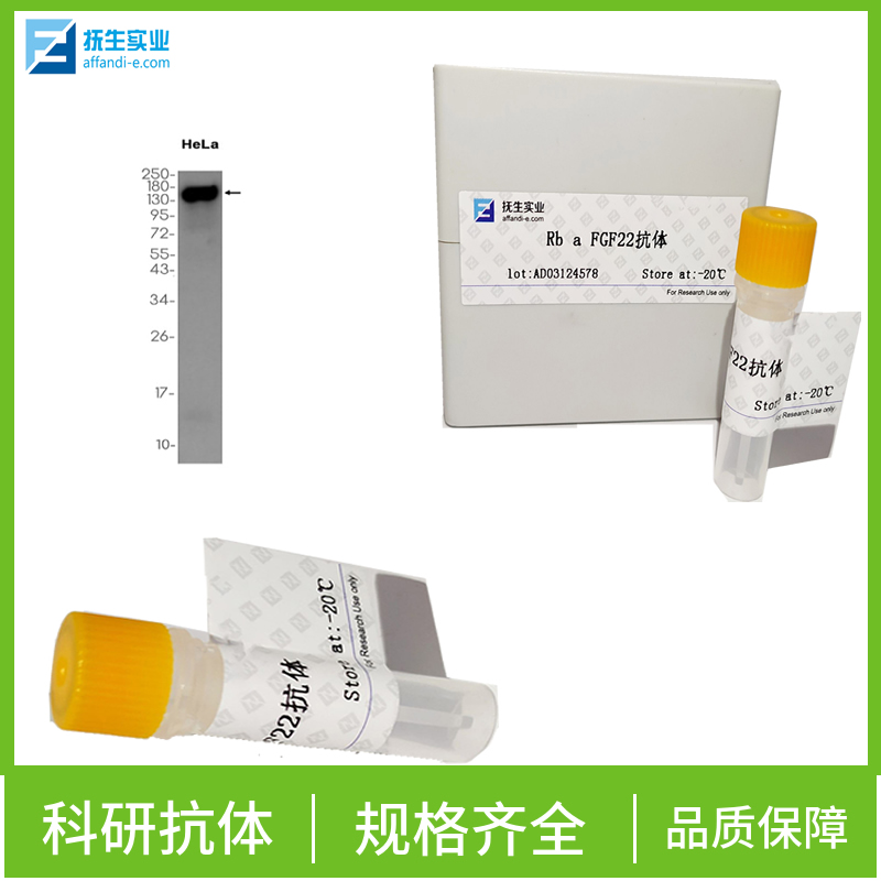 磷酸化p-IκB-α抗体,phospho-IKB alpha (Ser32 + Ser36) Rabbit pAb