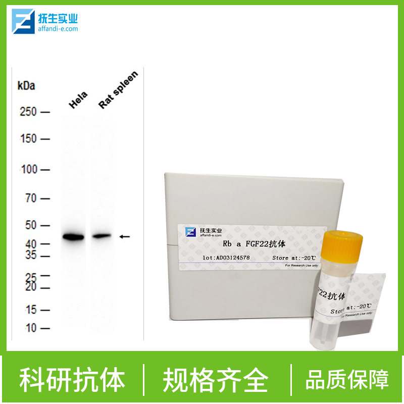 核呼吸因子-1抗体,NRF1 Rabbit pAb