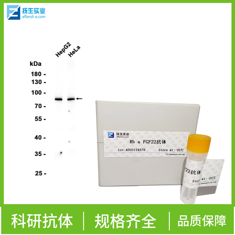 基质金属蛋白酶13抗体,MMP13 Rabbit pAb