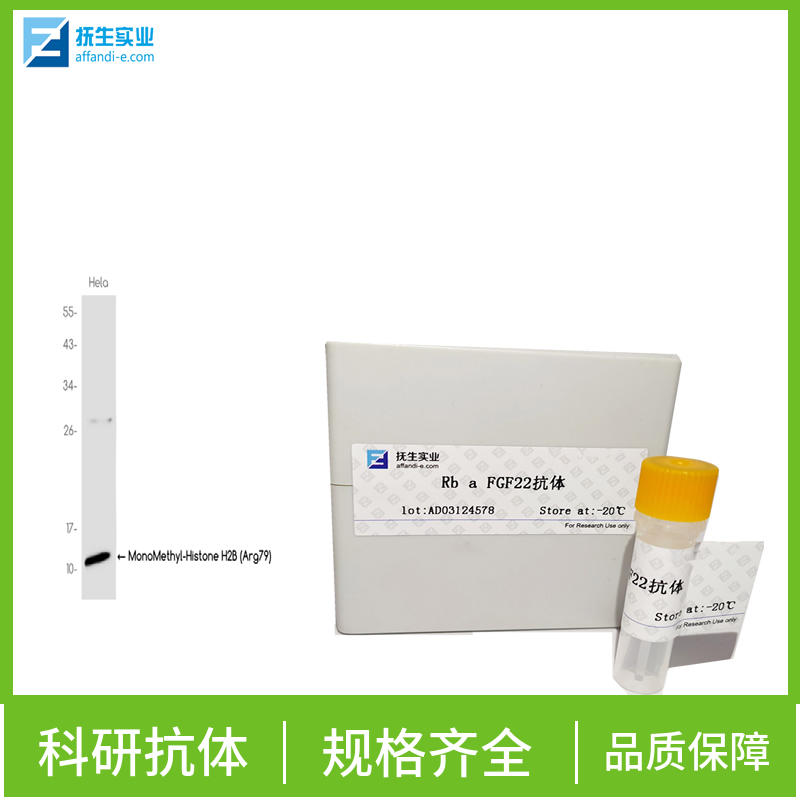 基质金属蛋白酶2抗体,MMP2 Rabbit pAb