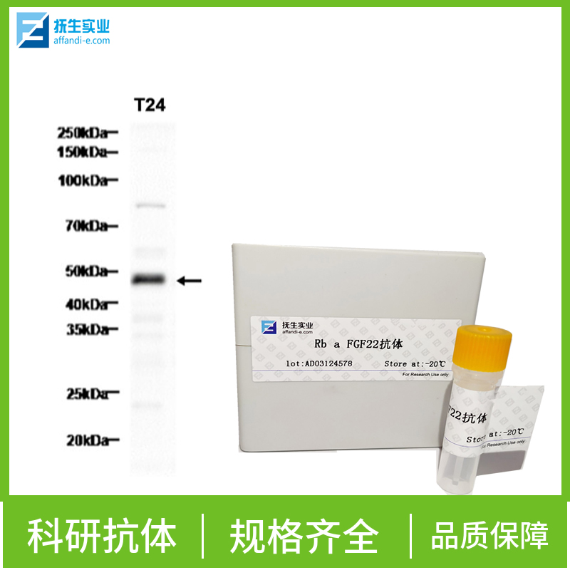 基质金属蛋白酶9抗体,MMP9 Rabbit pAb