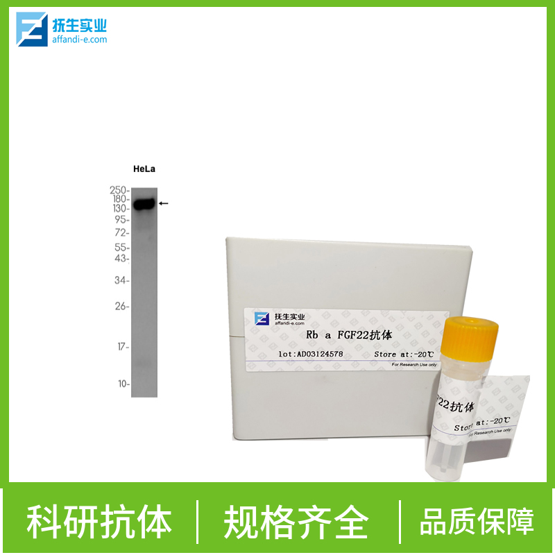 固醇酰辅酶A脱氢酶1抗体,SCD Rabbit pAb