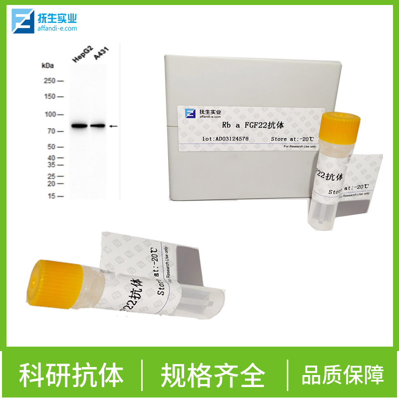 核受体共激活因子4抗体,NCOA4 Rabbit pAb