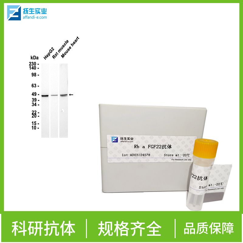 核糖核蛋白自身抗原抗体,TRIM21 Rabbit pAb