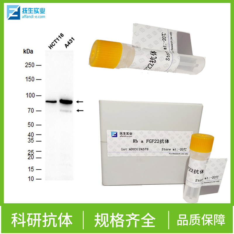 红细胞生成素受体抗体,EPOR Rabbit pAb