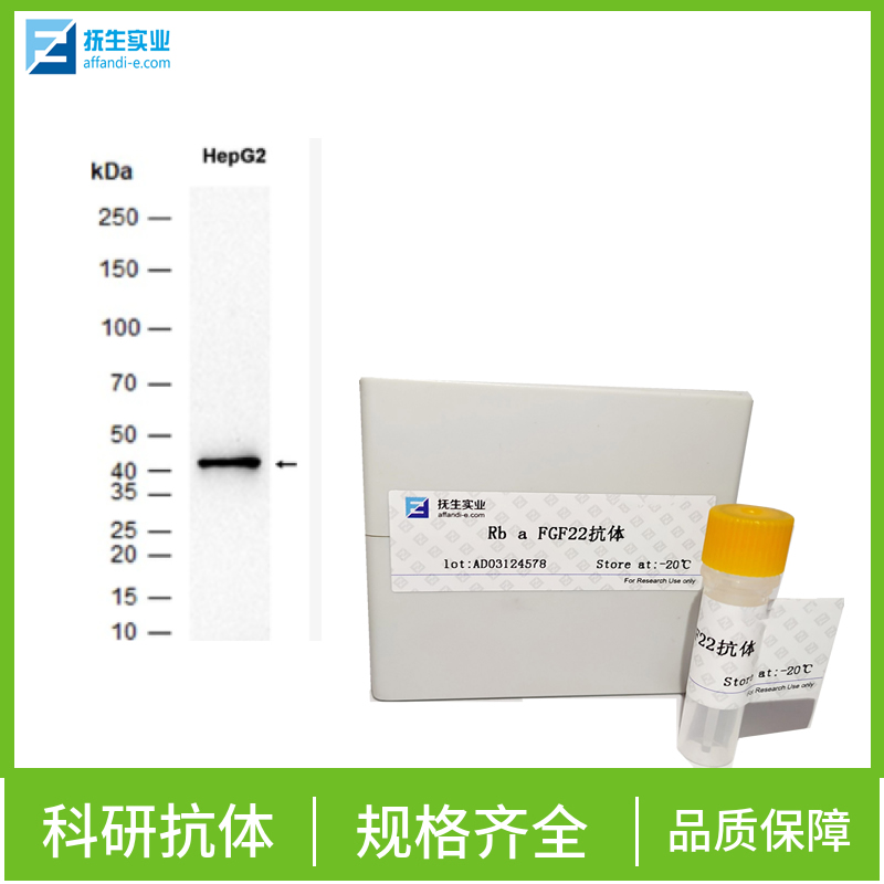 环腺苷酸应答元件结合蛋白5抗体,CREB5 Rabbit pAb