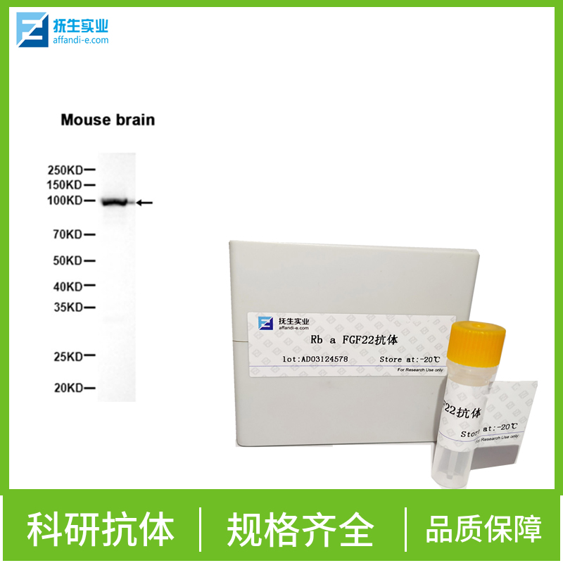 环腺苷酸应答元件结合蛋白单克隆抗体,CREB-1 Mouse mAb