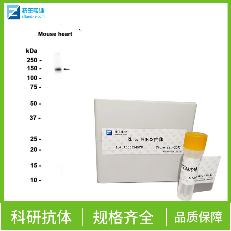 巢蛋白/神经上皮干细胞蛋白抗体,Nestin Rabbit pAb