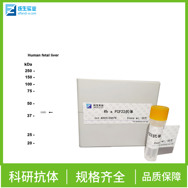 成视网膜细胞瘤基因抗体,Rb Rabbit pAb