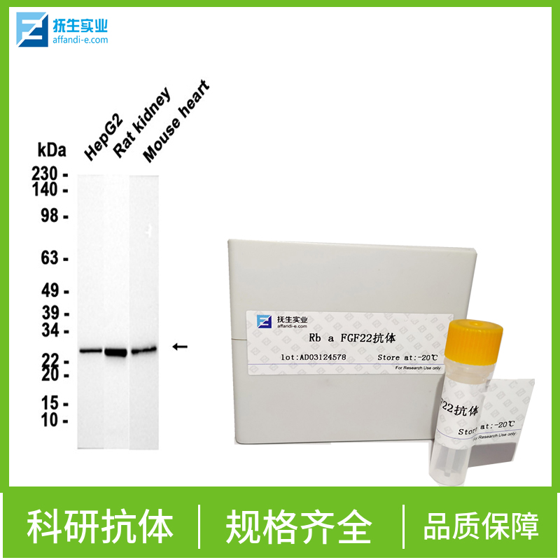 穿膜蛋白DLK1抗体（C端）,DLK1 Rabbit pAb