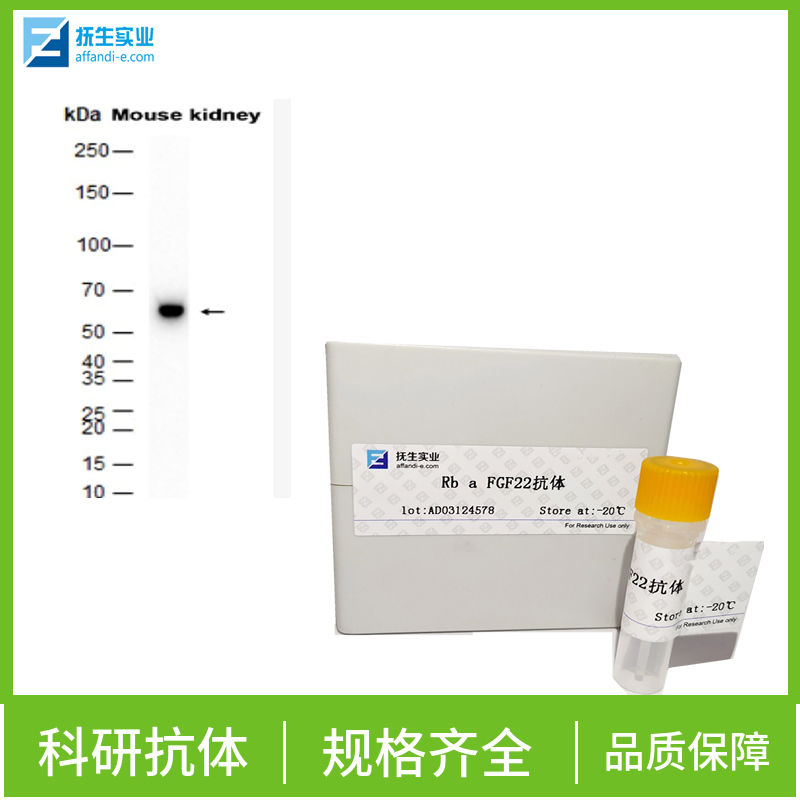 促甲状腺素受体抗体（C端）,TSHR (CT) Rabbit pAb