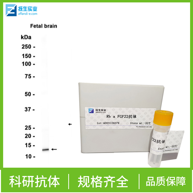 促胃泌素受体抗体,CCKBR Rabbit pAb