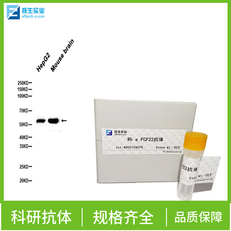 促性腺激素释放激素受体抗体,GnRHR Rabbit pAb