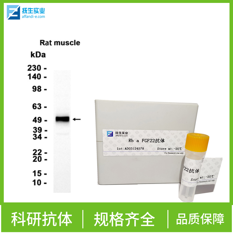 单纯疱疹病毒1型转录调节因子ICP22抗体,HHV11 ICP22 Rabbit pAb