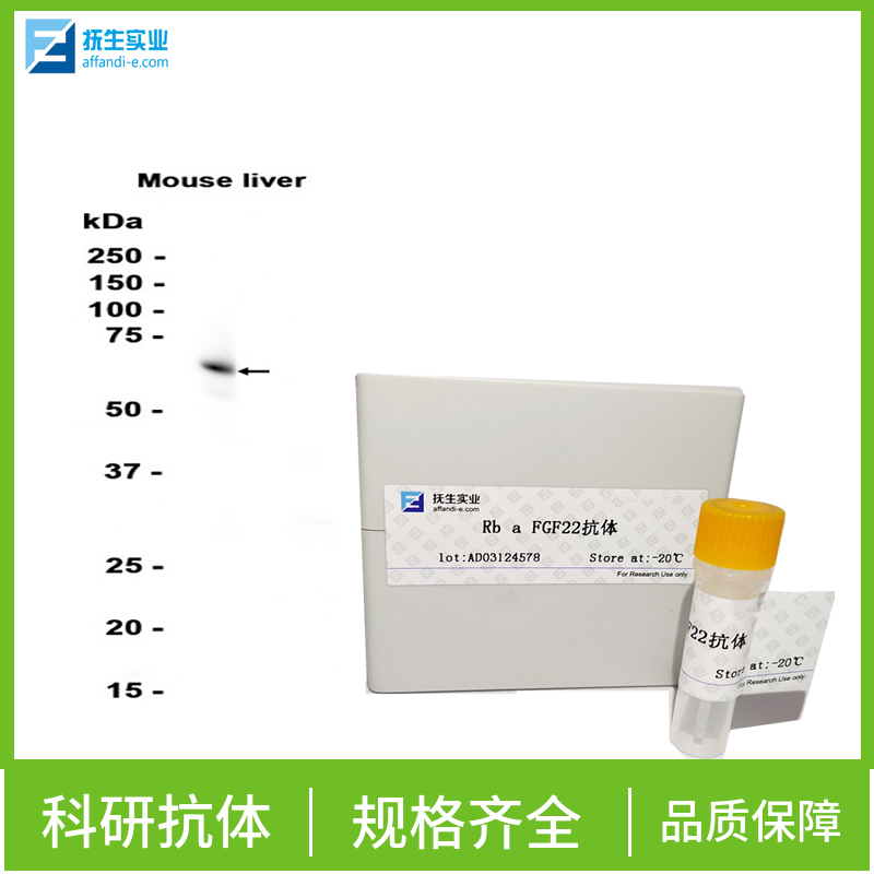 胆固醇调节元件结合蛋白1抗体,SREBP1 Rabbit pAb