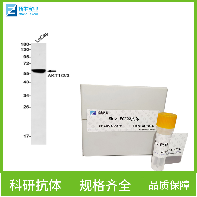 补体应答基因32抗体,RGC32/C13orf15 Rabbit pAb