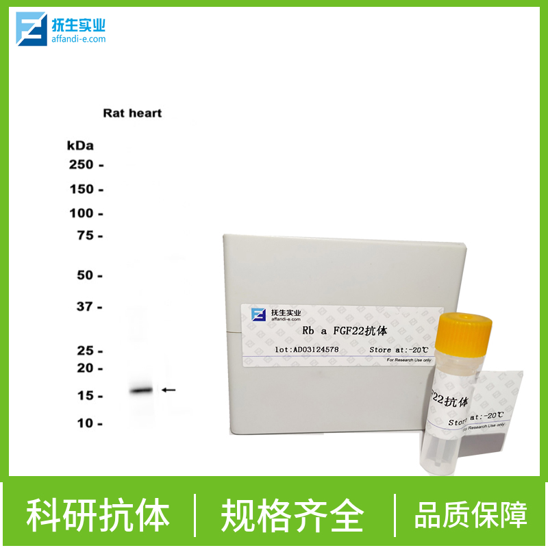 叉头蛋白J1抗体,HFH4 Rabbit pAb