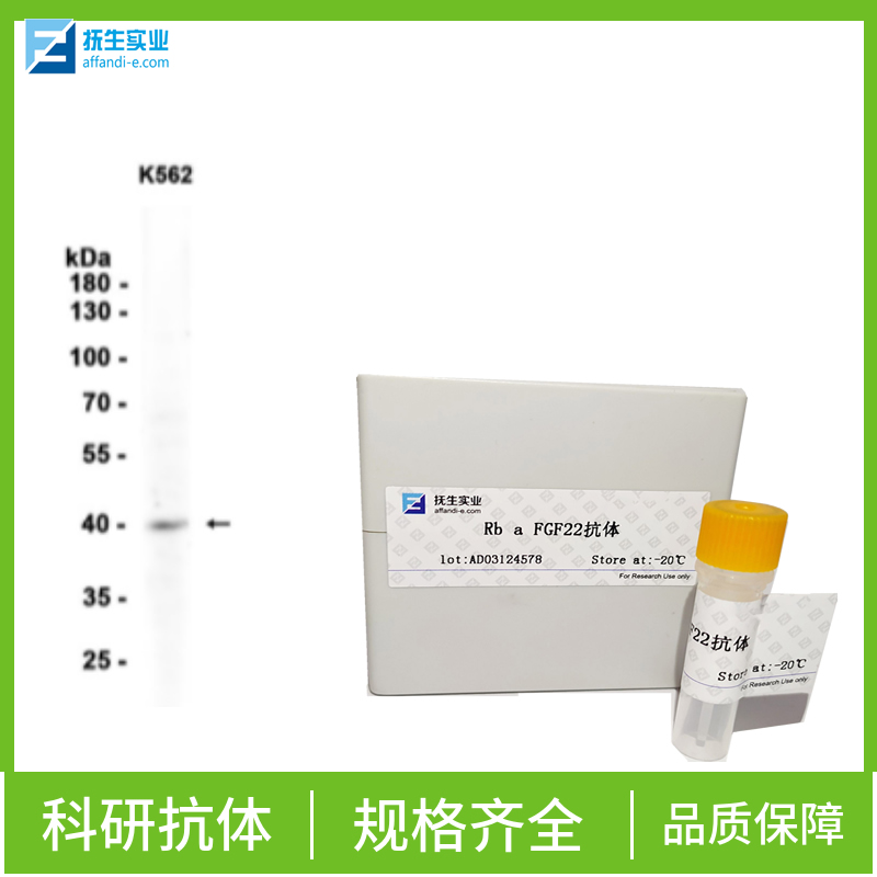 叉头蛋白P3抗体,FOXP3 Rabbit pAb