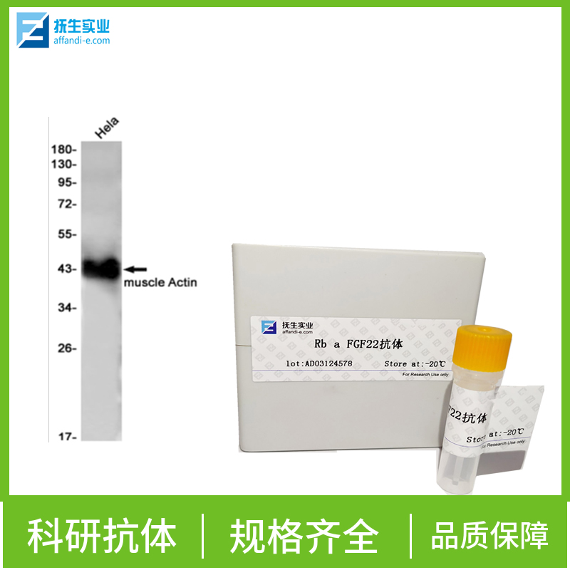 雌激素受体相关蛋白α抗体,ERR-alpha Rabbit pAb