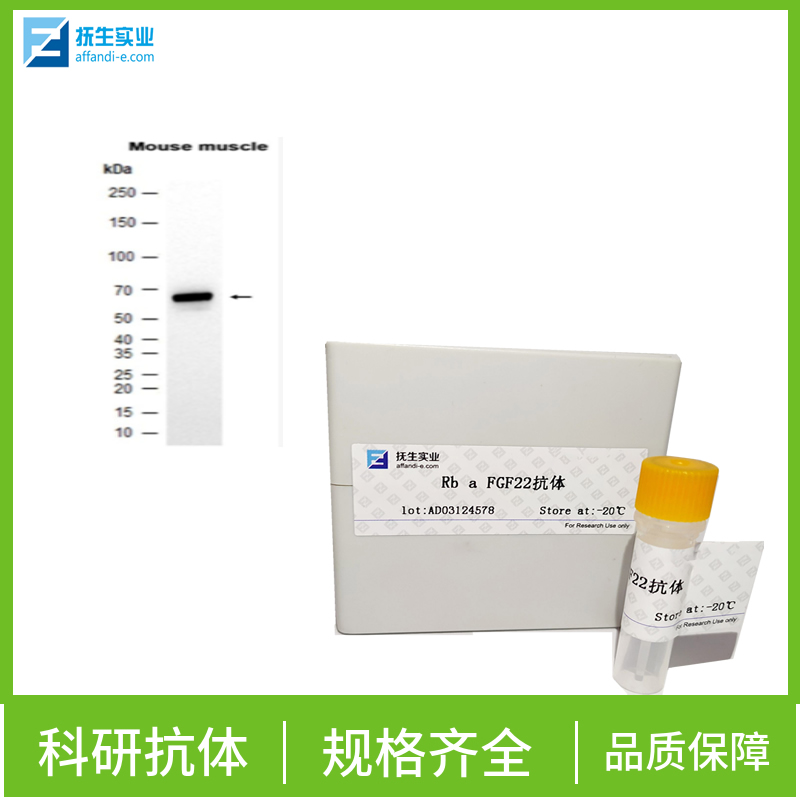 促凋亡调节蛋白BNIP3抗体,BNIP3 Rabbit pAb