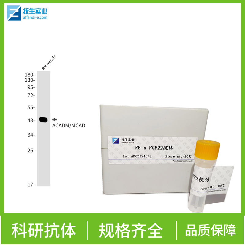 表皮生长因子受体III型突变体抗体,EGFRvIII Rabbit pAb