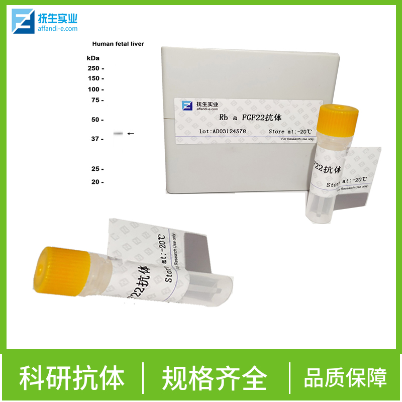 T淋巴细胞膜蛋白3（CD366）抗体,HAVCR2/TIM-3 Rabbit pAb