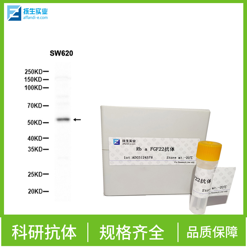 Z DNA结合蛋白抗体,Z DNA binding protein Rabbit pAb