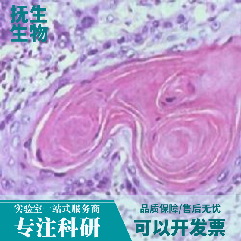 人单核白血病细胞带绿色荧光；THP-1/GFP,THP-1/GFP